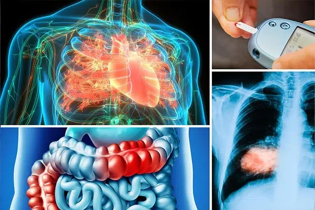 Everyday-habits-to-ease-inflammation