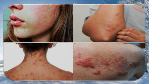 Skin problem in winter