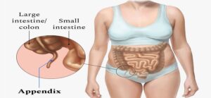 Appendix