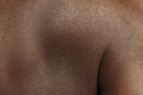 Dry Skin Causes Symptoms and the Best Ways to Treat It Naturally and Effectively