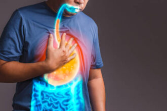 Eating Habits That Reduce Heartburn