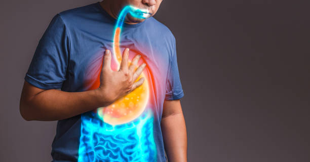 Eating Habits That Reduce Heartburn