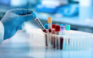 Blood test