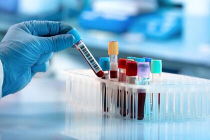 Blood test