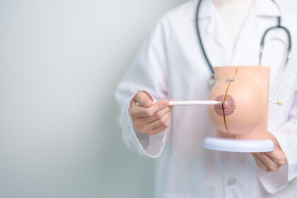 When Extra Breast Tissue Appears Understanding the Hidden Anatomy of the Body