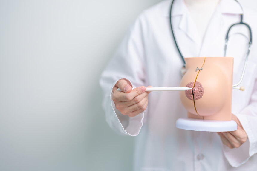 When Extra Breast Tissue Appears Understanding the Hidden Anatomy of the Body