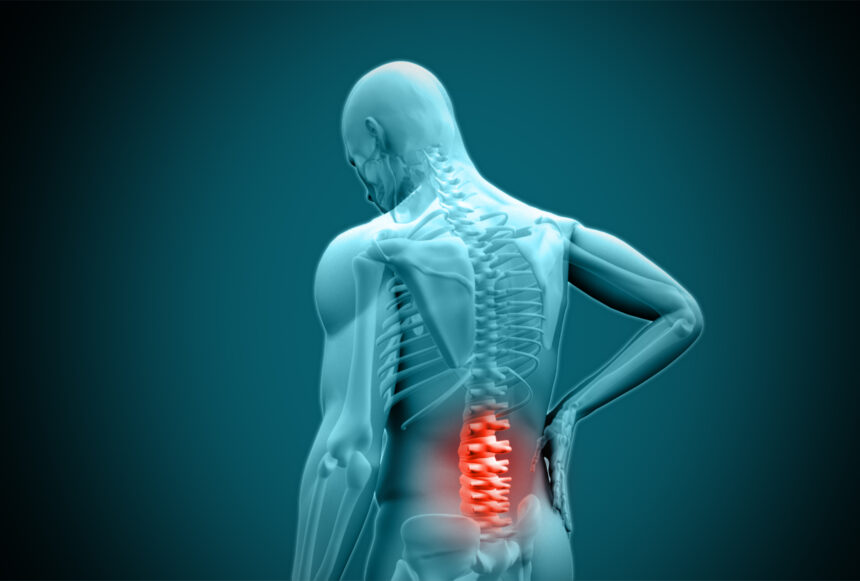 Back pain