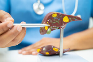 FoodanHealth 16 Liver Cancer