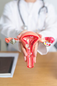 FoodanHealth 16 Ovarian cancer