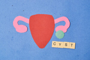 FoodanHealth 19 Polycystic Ovary Syndrome