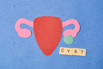 Polycystic Ovary Syndrome