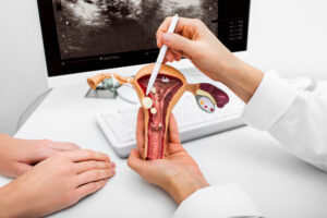 FoodanHealth 20 Uterine fibroids
