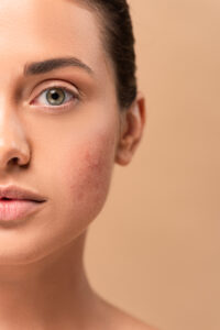 FoodanHealth 17 skin barrier