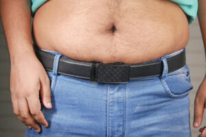 Belly Fat