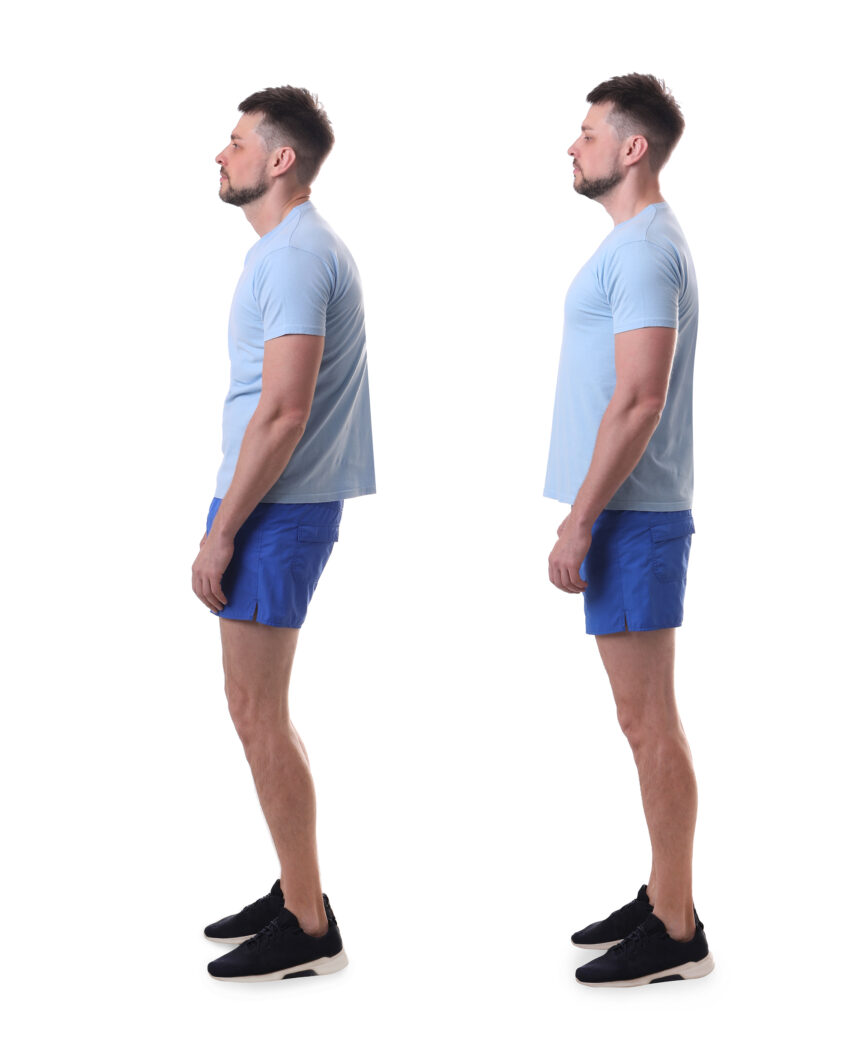 Exercises That Improve Posture