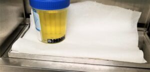 FoodanHealth 15 Foamy Urine