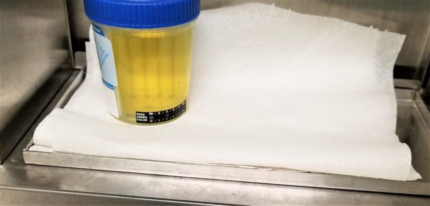 Foamy Urine