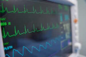 Fast Heartbeat