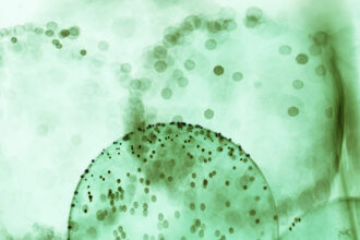 Malaria vs. Typhoid